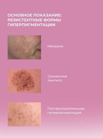 Mediderma Melaspeel R - Dung Dịch Peel Chuyên Sâu Cải Thiện Sắc Tố 60ml