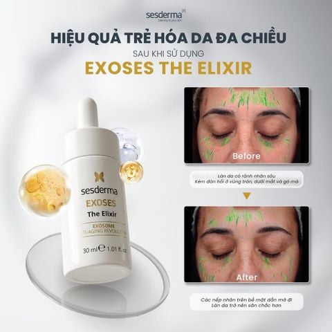 Sesderma Exoses The Elixir 30ml - Tinh Chất Chiết Tế Bào Gốc Exosome Sửa Chữa, Tân Tạo Tế Bào Và Trẻ Hoá Đa Chiều 30ml