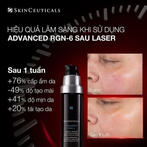 Kem dưỡng phục hồi SkinCeuticals Advanced RGN-6 Skin Repair Cream 50ml