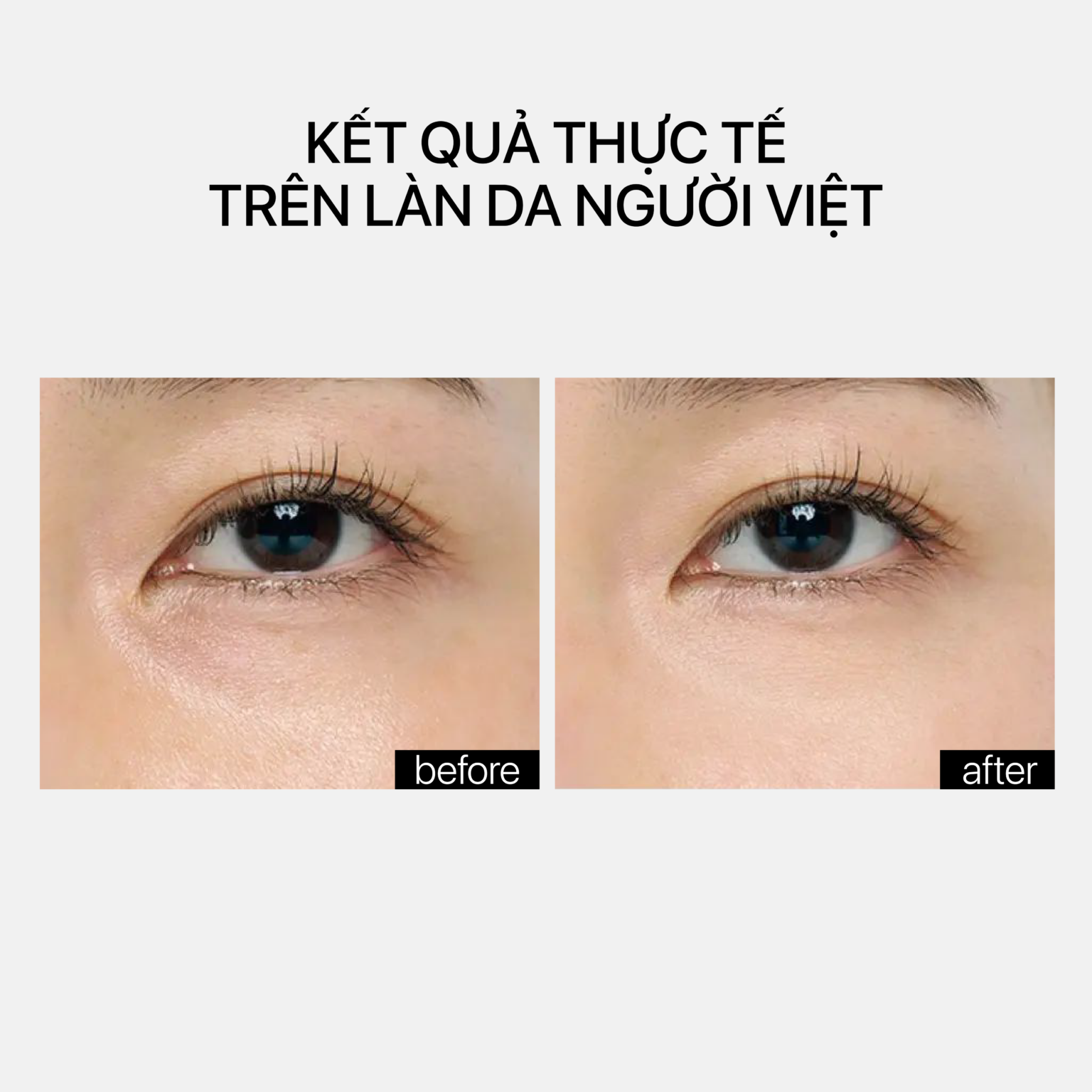 Theramid A Retinyl Retinoate - Tinh Chất Vitamin A, Tái Tạo Da Nhẹ Nhàng & Ổn Định 30ml