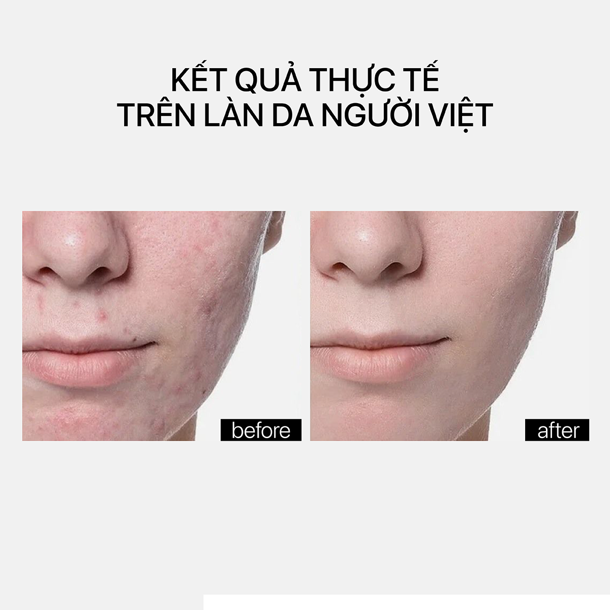 Theramid Copper Peptide - Tinh Chất Đồng Peptide Phục Hồi Da, Hỗ Trợ Tăng Sinh & Cải Thiện Độ Săn Chắc 30ml