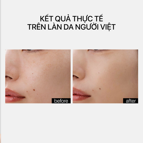 Theramid Lino-8 - Tinh Chất Chống Oxy Hóa, Làm Dịu & Cân Bằng Làn Da Nhạy Cảm 30ml