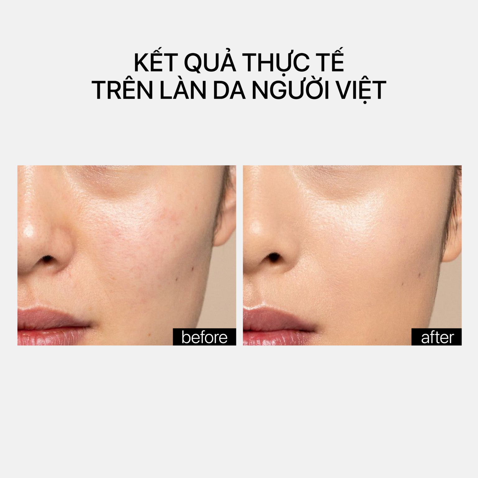 Theramid Smoothing Treatment - Tinh Chất Làm Mịn Da, Hỗ Trợ Căng Bóng & Cải Thiện Dấu Hiệu Lão Hóa 30ml