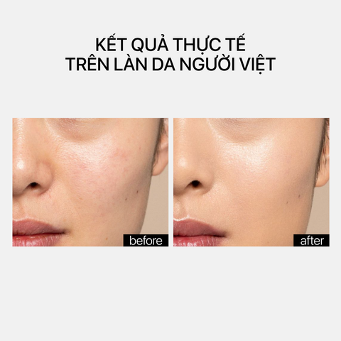 Theramid Smoothing Treatment - Tinh Chất Làm Mịn Da, Hỗ Trợ Căng Bóng & Cải Thiện Dấu Hiệu Lão Hóa 30ml