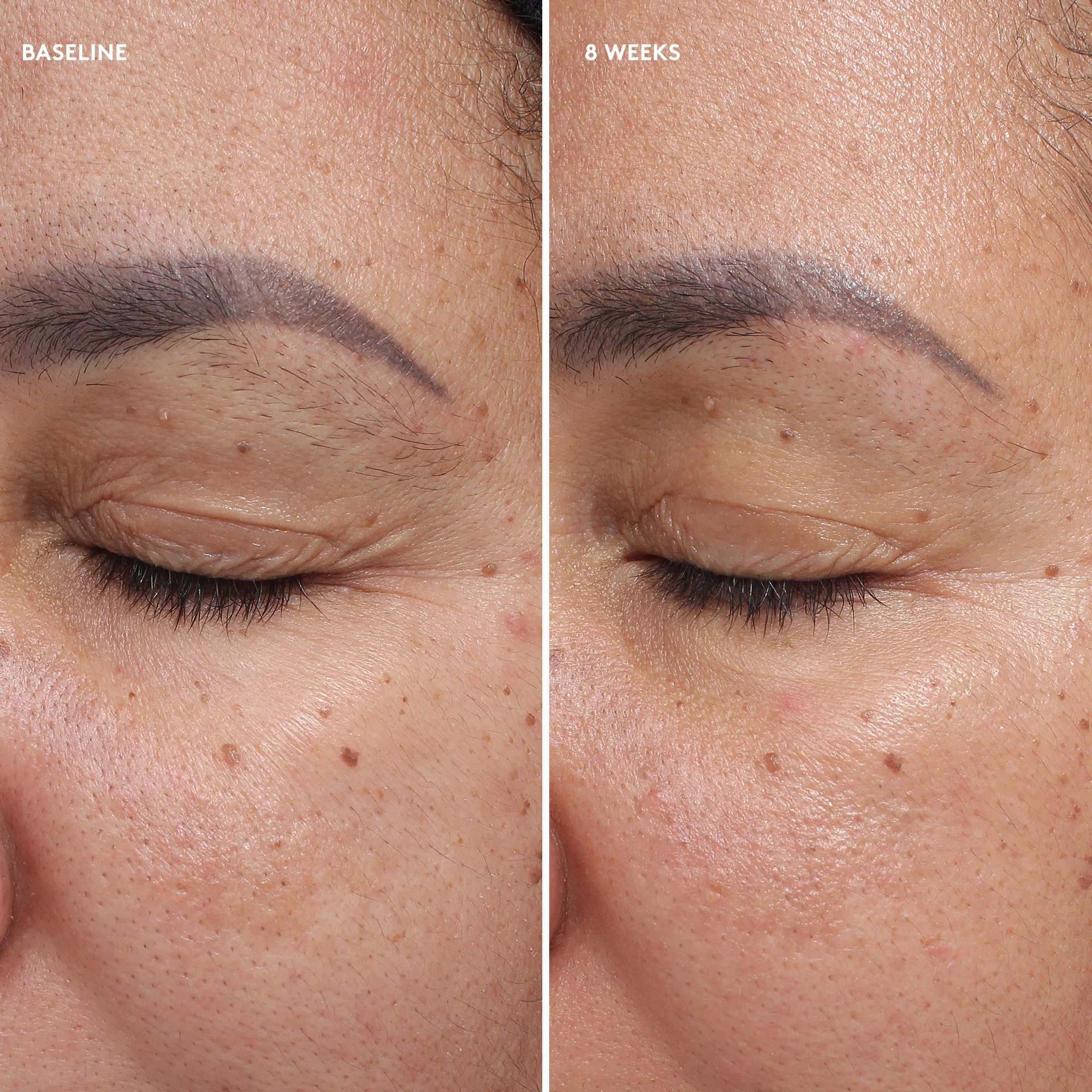 Colorescience Total Eye Firm & Repair Kem Mắt Phục Hồi Săn Mịn Và Chống Lão Hoá Vùng Mắt 18ml