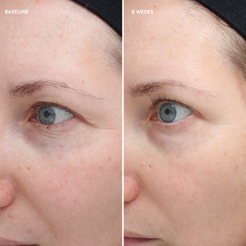 Colorescience Total Eye Firm & Repair Kem Mắt Phục Hồi Săn Mịn Và Chống Lão Hoá Vùng Mắt 18ml