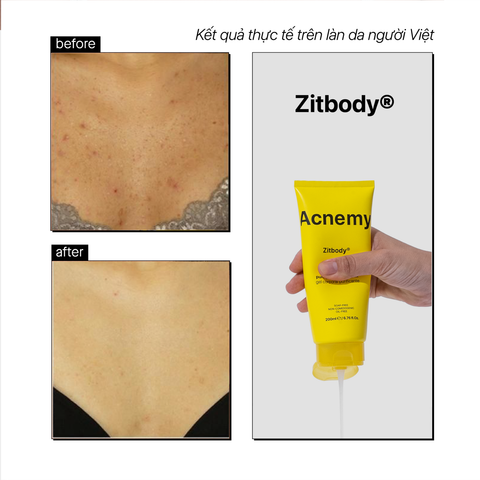 Acnemy Zitbody Clarifying Body Wash Sữa Tắm Làm Sạch Da Và Hỗ Trợ Làm Giảm Mụn Body 200ml