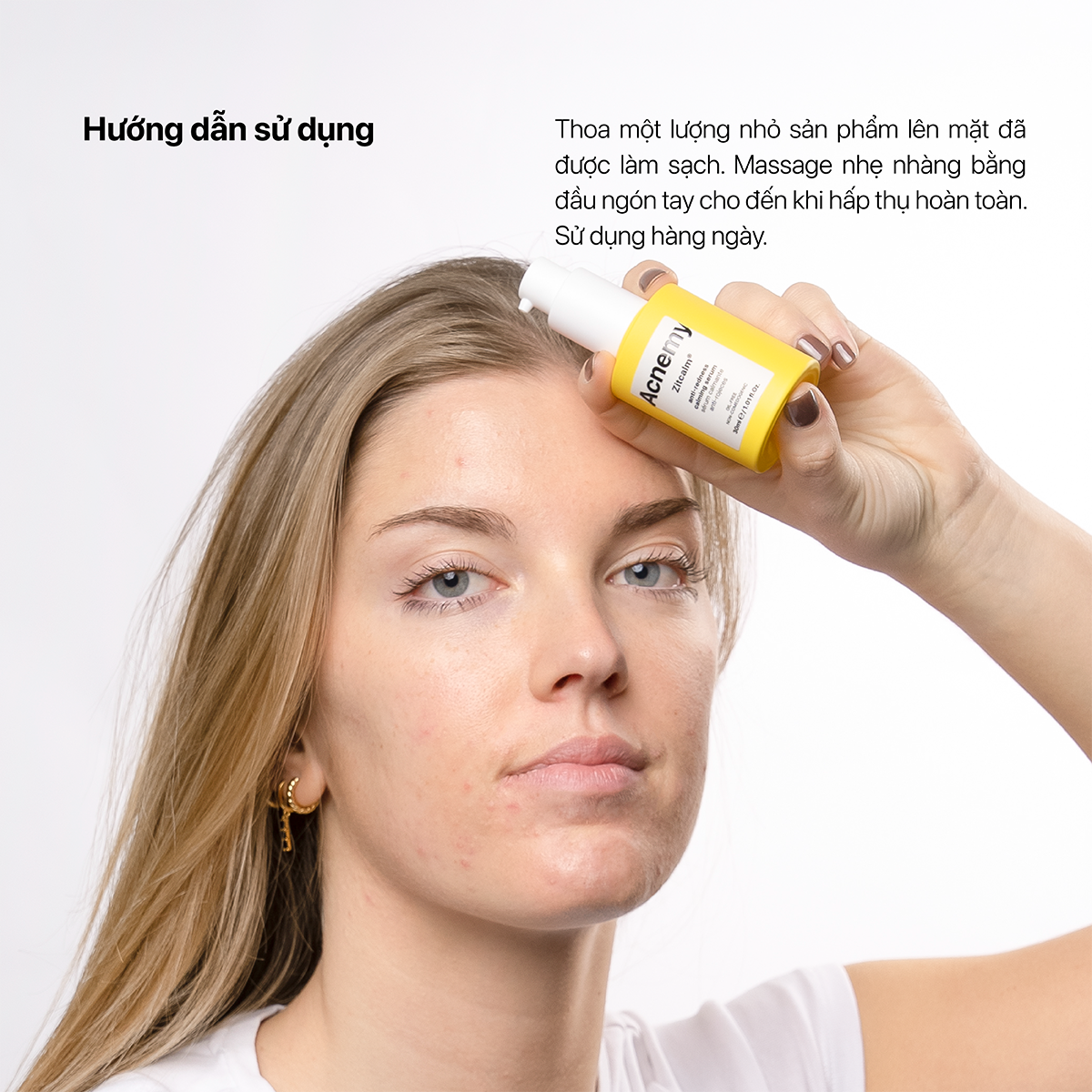 Acnemy Zitcalm Anti Redness Calming Serum Tinh Chất Làm Dịu Da Mụn Và Giảm Tình Trạng Đỏ Da 30ml