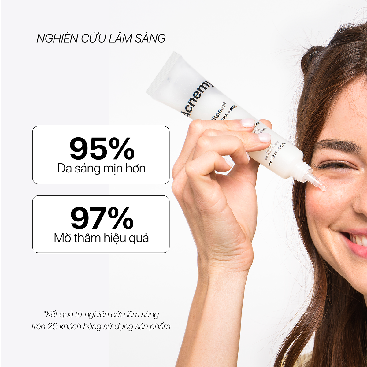 Acnemy Zitpeel AHA BHA PHA Thay Da Sinh Học Hỗ Trợ Làm Giảm Mụn Và Làm Mịn Da 40ml