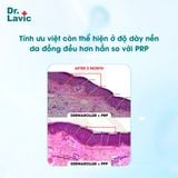  Bộ PPP chuyên nghiệp 2 lọ/bộ Dr.lavic DR920 