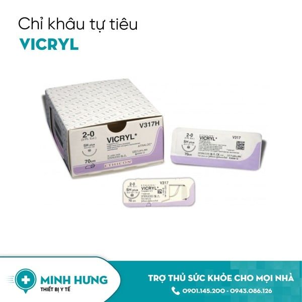 Chỉ Khâu Tự Tiêu Vicryl 1/0