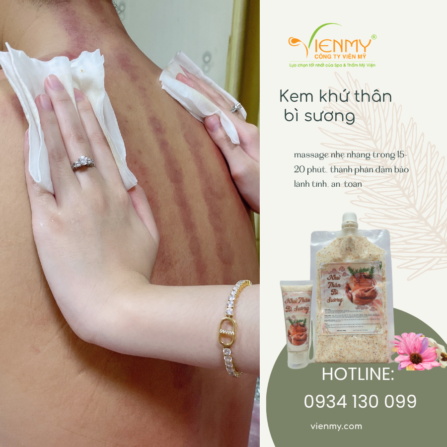  Kem tẩy tế bào chết body Khứ Thân Bì Sương ZENori 