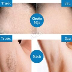 Máy cạo lông mặt KEMEI KM-151 2 Trong 1 Mini - Máy tỉa lông mày, Cạo ria mép êm ái & Sạc USB tiện lợi - Chính hãng