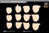 MEGAMI DEVICE M.S.G 08 FACE SET BUSTER DOLL SKIN COLOR A | Kotobukiya Goods