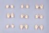 MEGAMI DEVICE M.S.G 09 Hand Set Skin Color A 1/1 - Megami Device | Kotobukiya Plastic Model