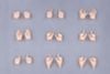 MEGAMI DEVICE M.S.G 09 HAND SET SKIN COLOR B - Megami Device | Kotobukiya Plastic Model