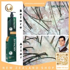 Dầu gội trị gàu, giảm dầu nhờn viêm da đầu và ngăn bết tóc AROMASE Oily Scalp Balancing Shampoo 400ml