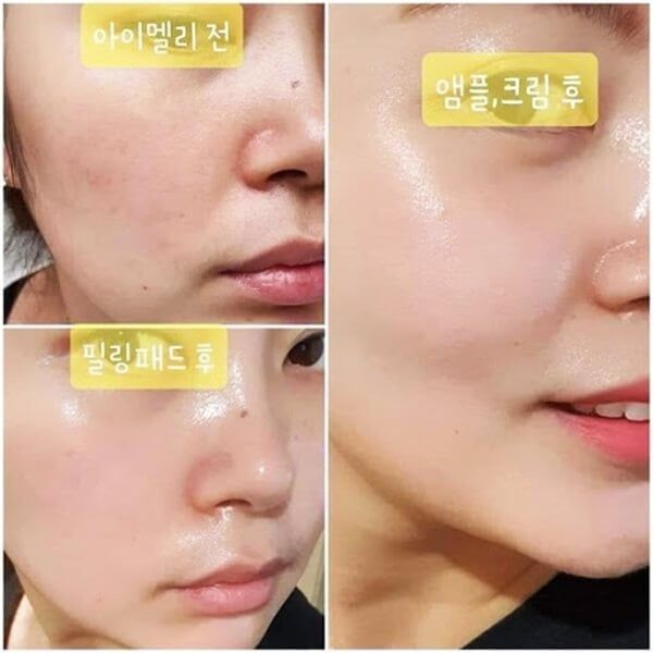 TINH CHẤT SERUM VÀNG 24K CAO CẤP LEBELAGE HEE YUL PREMIUM GOLD ESSENCE
