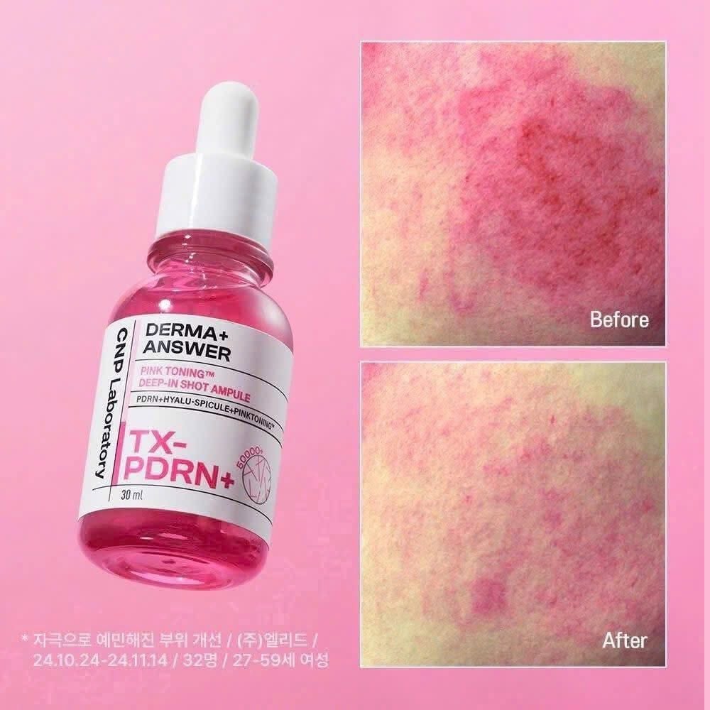 [ Tem LG ] Tinh Chất CNP Derma Answer Mela Spot Brightening Ampule Vit C /Active Boost Ampule PDRN /Pink Toning Deep-In Shot Ampule
