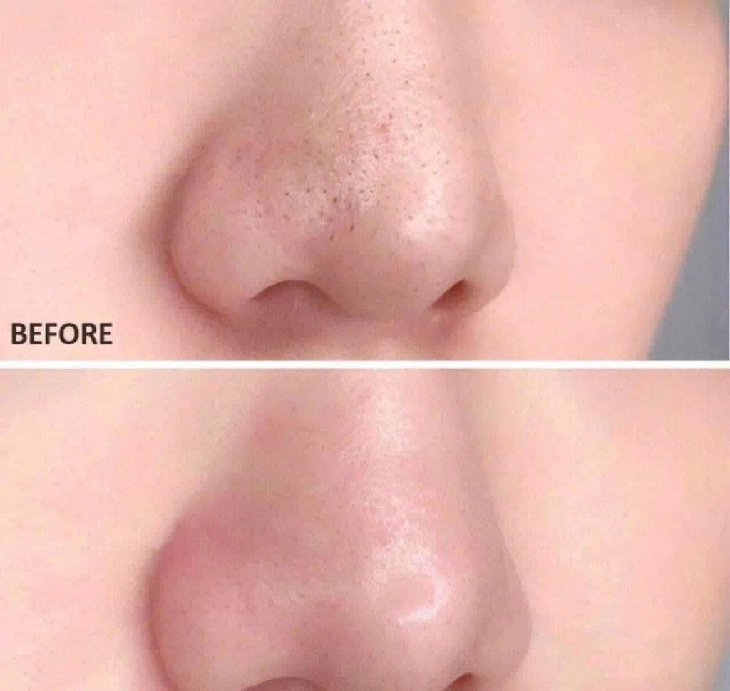 [ Tem LG ] Tẩy Tế Bào Chết CNP Laboratory Invisible Peeling Booster Essence 100ml