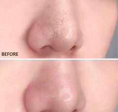 [ Tem LG ] Tẩy Tế Bào Chết CNP Laboratory Invisible Peeling Booster Essence 100ml