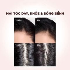 Bộ Dầu Gội Dầu Xả L’Oréal Elseve Full Resist 400ml