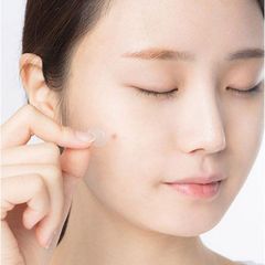 Miếng Dán Mụn Some By Mi Clear Spot Patch