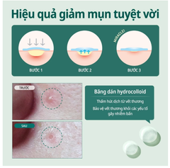 Miếng Dán Mụn Some By Mi Clear Spot Patch