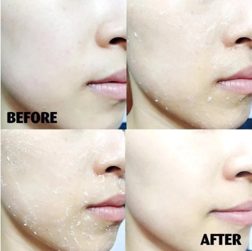 Tẩy Da Chết Innisfree Green Barley Mild Peeling Gel 120ml