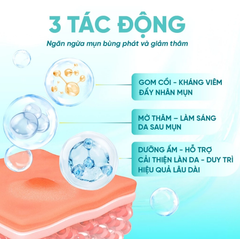 Kem Acne DermaX Derma Gel Hỗ Trợ Giảm Mụn, Giảm Thâm
