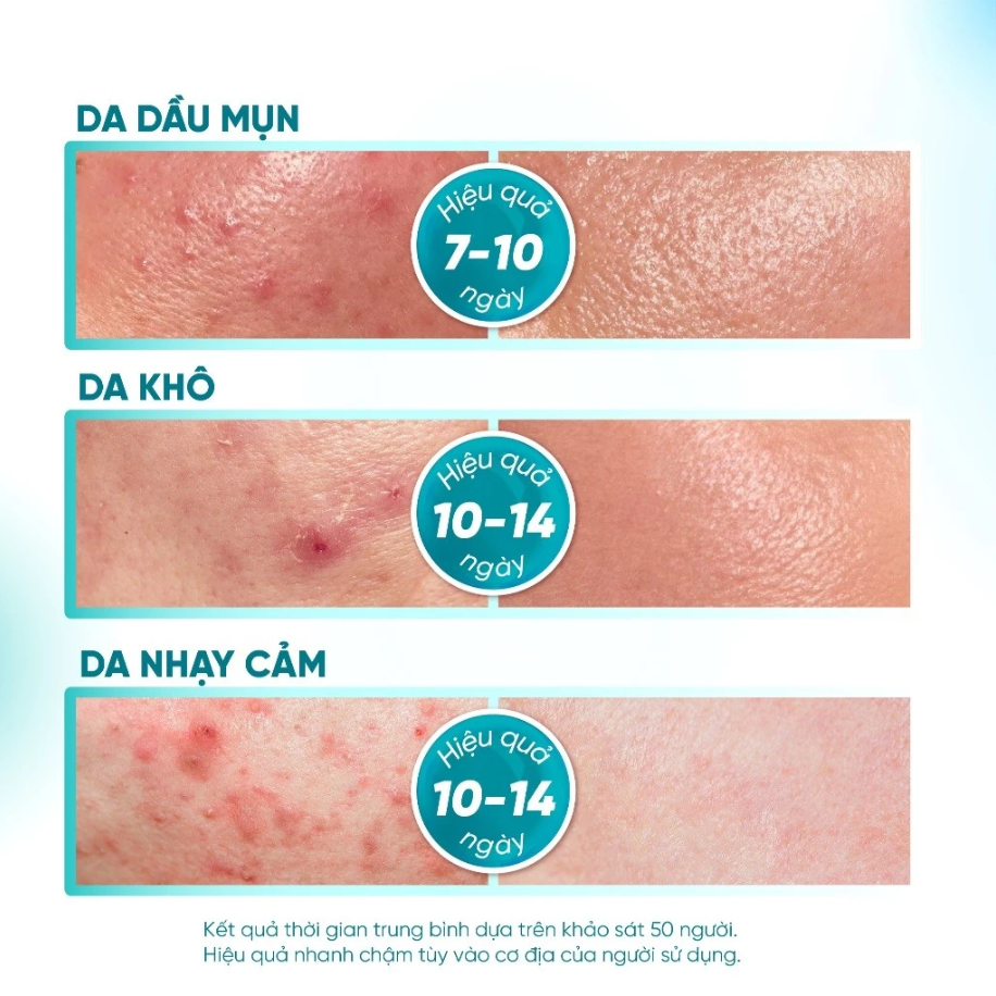 Kem Acne DermaX Derma Gel Hỗ Trợ Giảm Mụn, Giảm Thâm