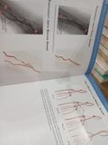  Patel's Atlas of Transradial Intervention: The Basics - Tejas Patel, Sanjay Shah, Alok Ranjan 