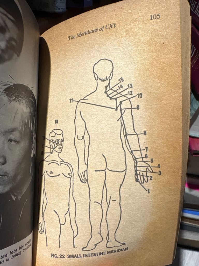  Acupuncture - Marc Duke 