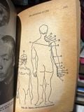  Acupuncture - Marc Duke 