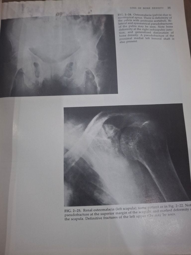  Radiology Of Bone Diseases - George B. Greenfield 