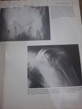  Radiology Of Bone Diseases - George B. Greenfield 