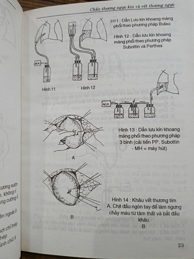  Bài Giảng Bệnh Học & Điều Trị Ngoại Khoa: Lồng Ngực, Tim Mạch, Niệu, Ngoại Nhi, Ngoại Thần Kinh - Nguyễn Đình Hối (Chủ Biên) 