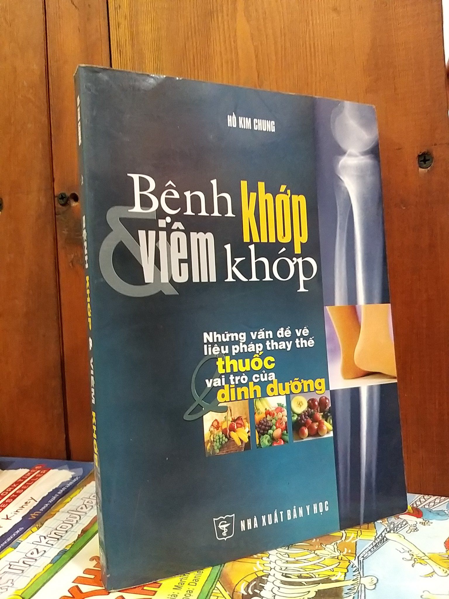  Bệnh khớp và viêm khớp - Hồ Kim Chung 