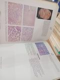  Atlas of Breast Cancer - Daniel F. Hayes 