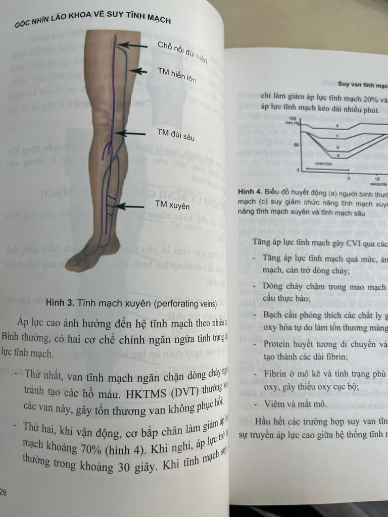  Góc Nhìn Lão Khoa Về Suy Tĩnh Mạch - Nguyễn Văn Trí 