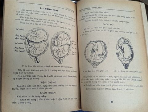 Tôi hộ sinh nguyên lý thực nghiệm sản khoa - V.N.Hoàng & Linh Ba