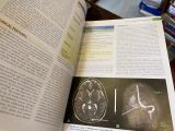 Merritt’s Neurology, 13 edition 