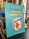  Viêm họng amidam và VA - PGS,TS. Nguyễn Hữu Khôi 