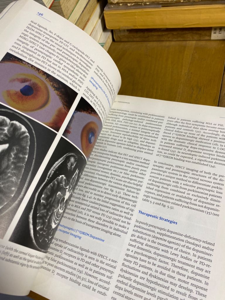  Parkinsonism And Related Disorders 