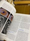  Parkinsonism And Related Disorders 