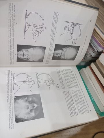 Reconstructive Plastic Surgery: The Head And Neck – Converse 