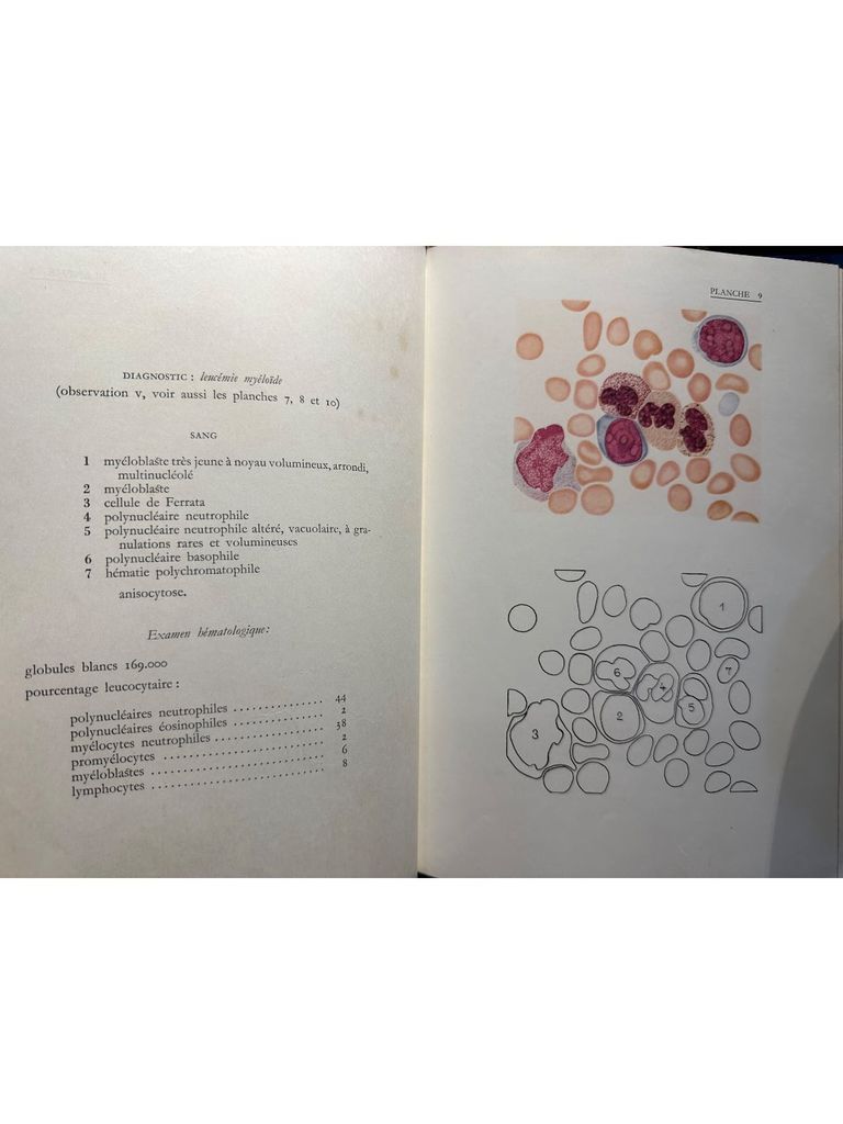  Atlas D'Hematologie 
