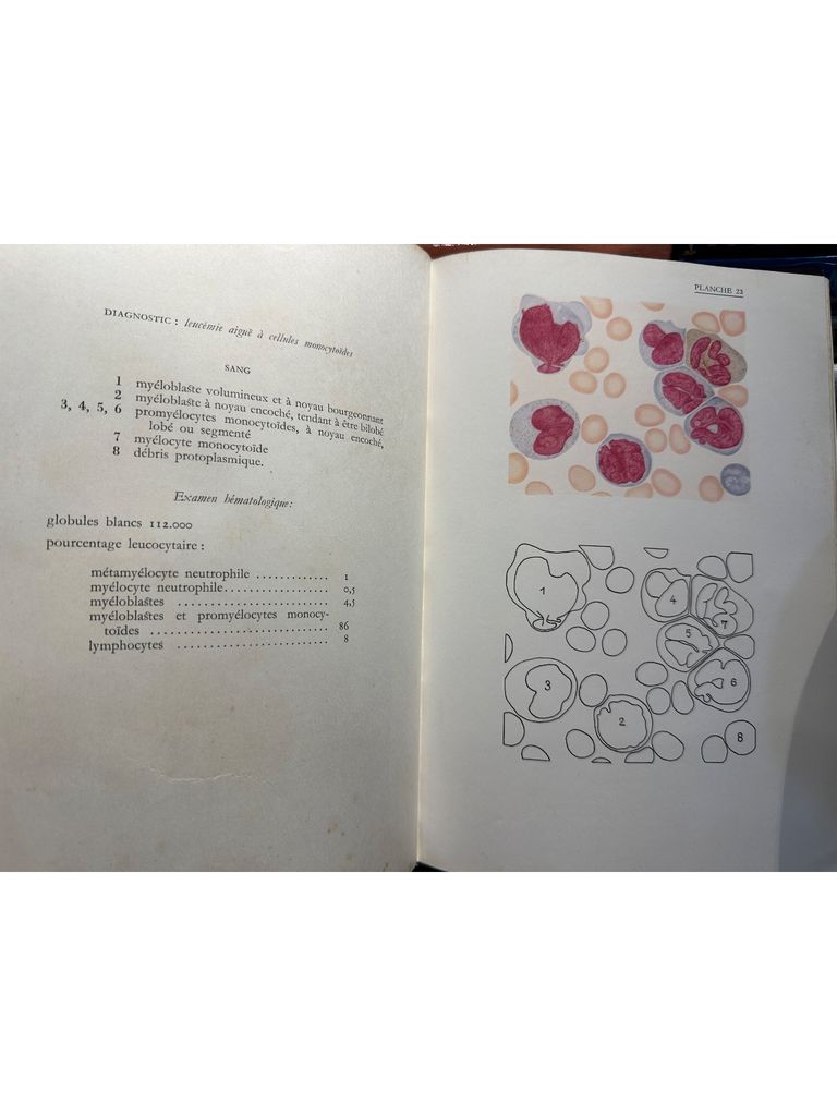  Atlas D'Hematologie 