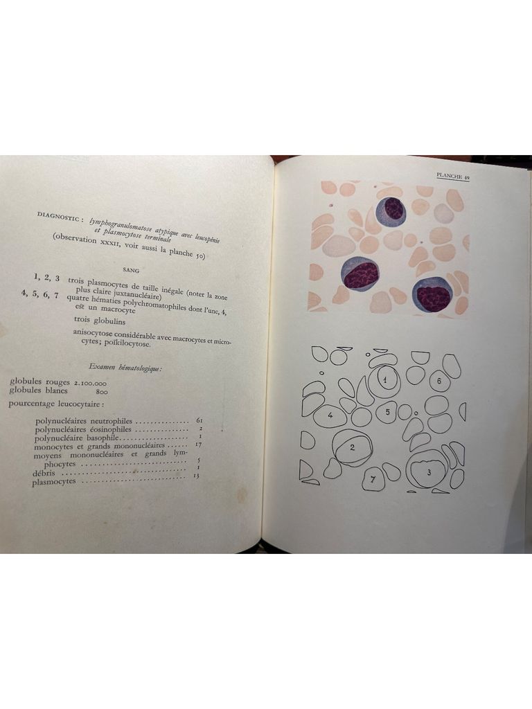  Atlas D'Hematologie 