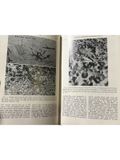  Human Neuroanatomy – Raymond C. Truex, Malcolm B. Carpenter 
